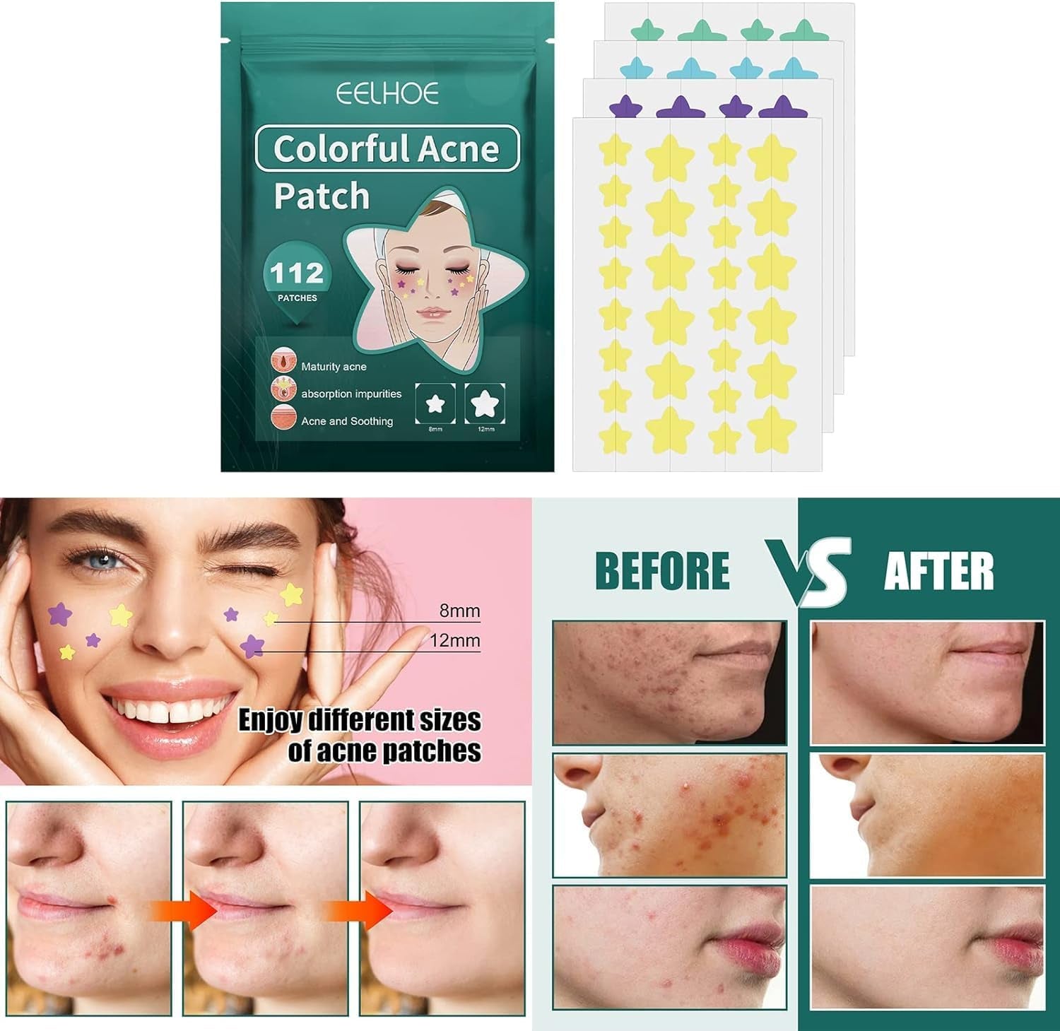 112Pcs Invisible Removal Pimple Patches Star Tools Concealer Face Scars Care Stickers Pimple Patches Treatments Blemish Zit Patches,Tools and Accessories