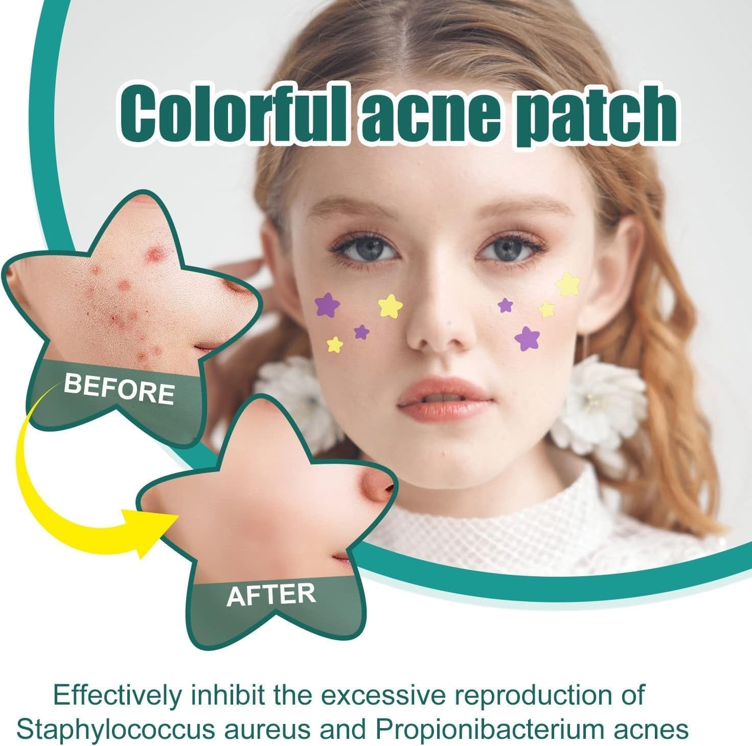 112Pcs Invisible Removal Pimple Patches Star Tools Concealer Face Scars Care Stickers Pimple Patches Treatments Blemish Zit Patches,Tools and Accessories